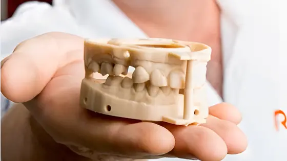 3D Dental Resin